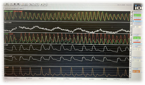 Fetal Cardiovascular Recording