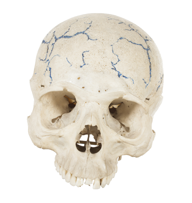histtrasp1