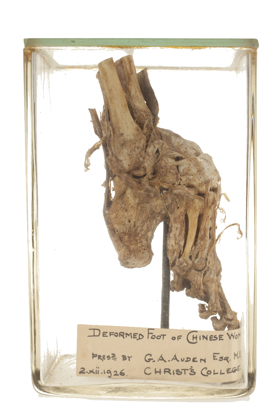legtrasp13