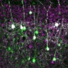 image rabies host cells