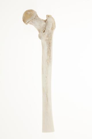 MG 2872