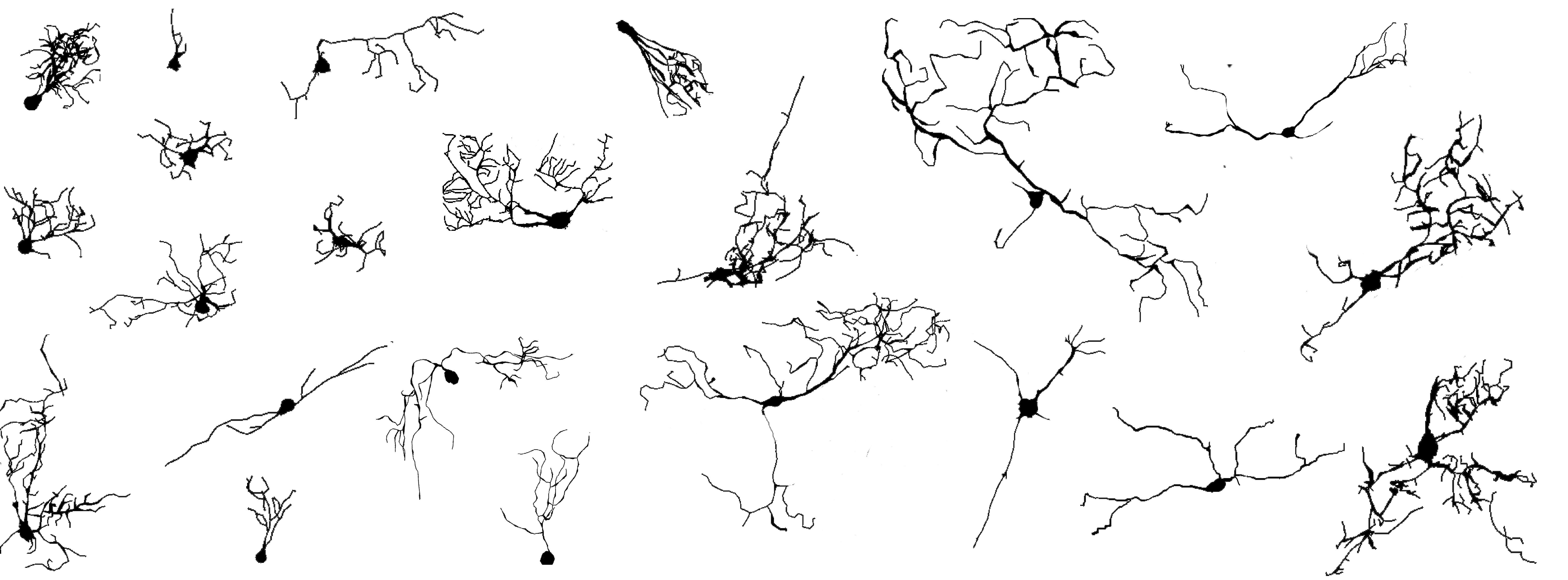 morphological heterogeneity of bulbar dopaminergic neurons (Adapted from Galliano et al, eLife 2018)
