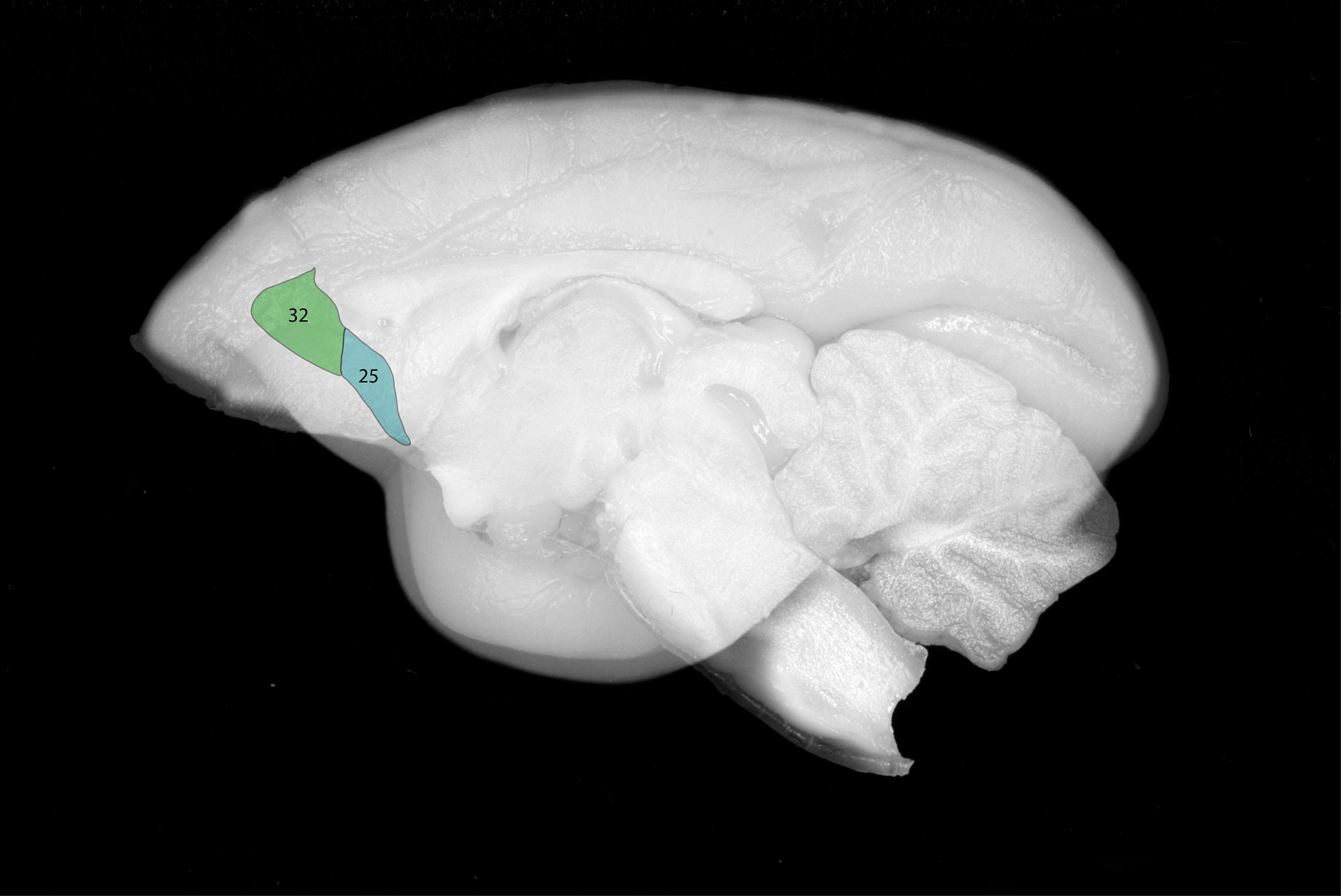 Marmoset brain with Areas 25 and 32 highlighted