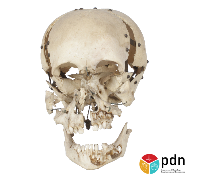 Human skull