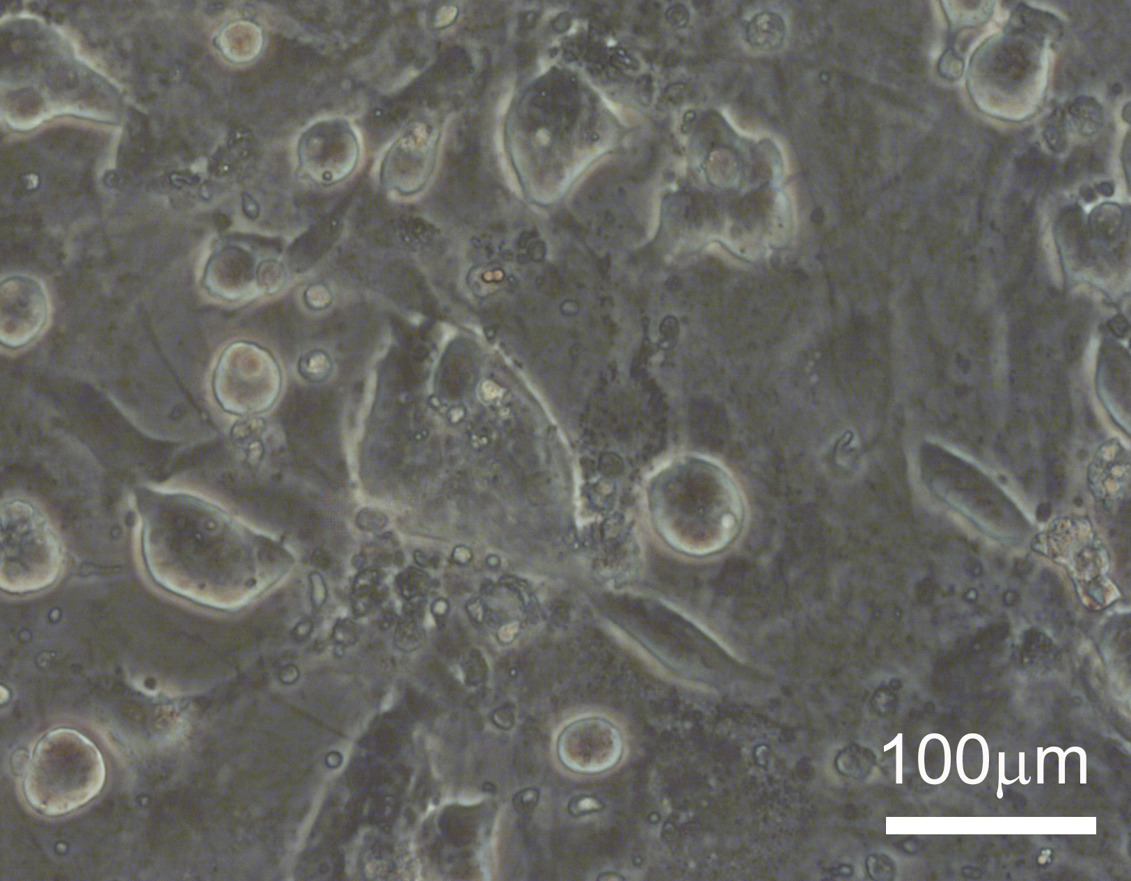 Epiblast-like marmoset embryonic stem cells Epiblast-like marmoset embryonic stem cells
