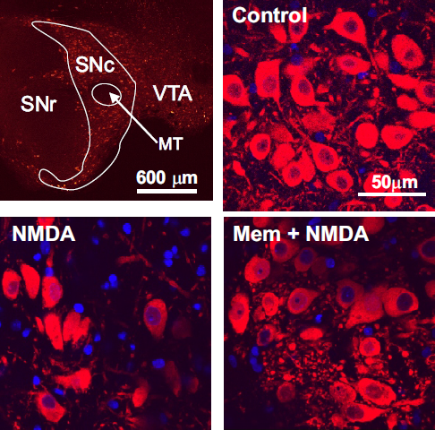 dopamine neurons Dopamine neurons in the substantia nigra have been immunolabelled with an antibody (red) and a nuclear stain (blue) to enable us to determine the density of dopamine neurons under different conditions. NMDA reduces the density, and this effect is reversed