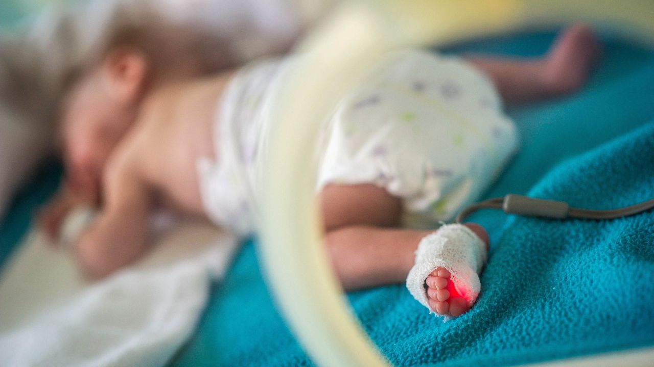 Picture of a premature baby