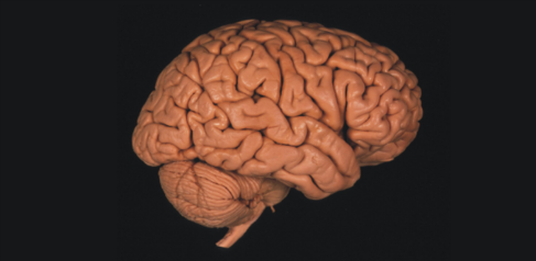 brain carousel