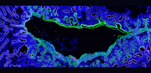 Image of a marmoset embryo implanting into the uterus. The embryo (blue, central) expands to fill out the cavity and establishes only superficial contact with the uterus (green)