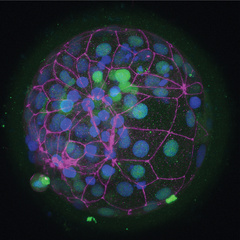 ZO-1 and OCT4 staining of a human blastocyst - please credit Norah Fogarty and Kathy Niakan
