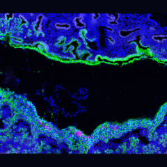 Image of a marmoset embryo implanting into the uterus. The embryo (blue, central) expands to fill out the cavity and establishes only superficial contact with the uterus (green)