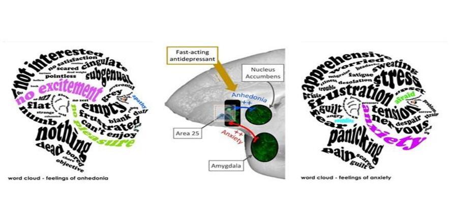 Medial view of a marmoset brain