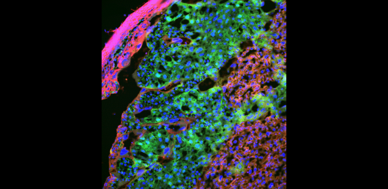Image showing the signalling cells (in green) of the mouse placenta that are key for remote controlling the metabolism of the mother to support nutrient supply and growth of the fetus (image credit – Sferruzzi-Perri lab)