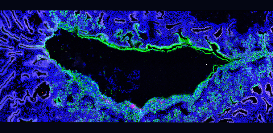 Image of a marmoset embryo implanting into the uterus. The embryo (blue, central) expands to fill out the cavity and establishes only superficial contact with the uterus (green) Image of a marmoset embryo implanting into the uterus. The embryo (blue, central) expands to fill out the cavity and establishes only superficial contact with the uterus (green)