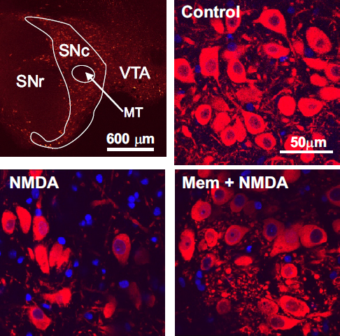 Dopamine neurons in the substantia nigra have been immunolabelled with an antibody (red) and a nuclear stain (blue) to enable us to determine the density of dopamine neurons under different conditions. NMDA reduces the density, and this effect is reversed