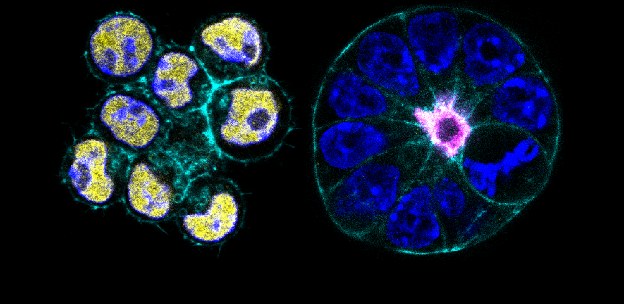 Pluripotency regulates mouse and human embryonic morphogenesis: cells that are in an unrestricted naive pluripotent state (marked by the expression of Nanog in yellow) fail to undergo proper morphogenesis and form the amniotic cavity (left structure). Los