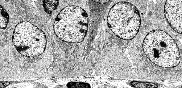 Small intestine epithelium   electron micrograph