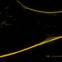 Expansion microscopy image of D. melanogaster neuron.