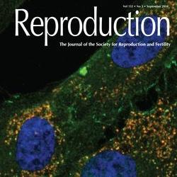 Hiat1 gene is required for male fertility in mice