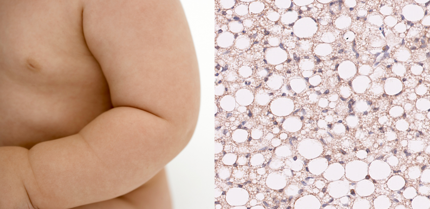 Fat fetuses: thyroid hormone deficiency before birth modifies adipose tissue development