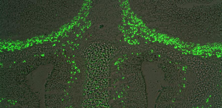Insight into development of cells in the nose that can promote nerve repair