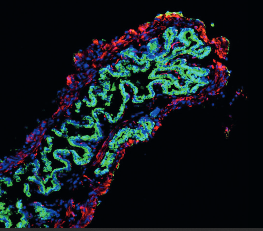 The body in miniature - organoid research at Meritxell Huch's lab